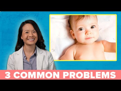 3 Common Eye Problems in Babies