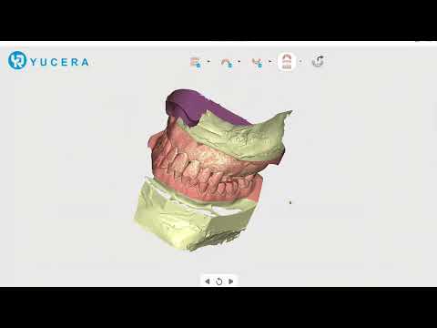 Yucera RS300 Dental Lab Scanner - Best speed & precision  10μm accuracy scan accuracy .
