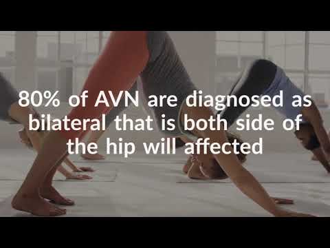 Avascular Necrosis and Minimally Invasive Treatment Using Cell Therapy - Regrow®