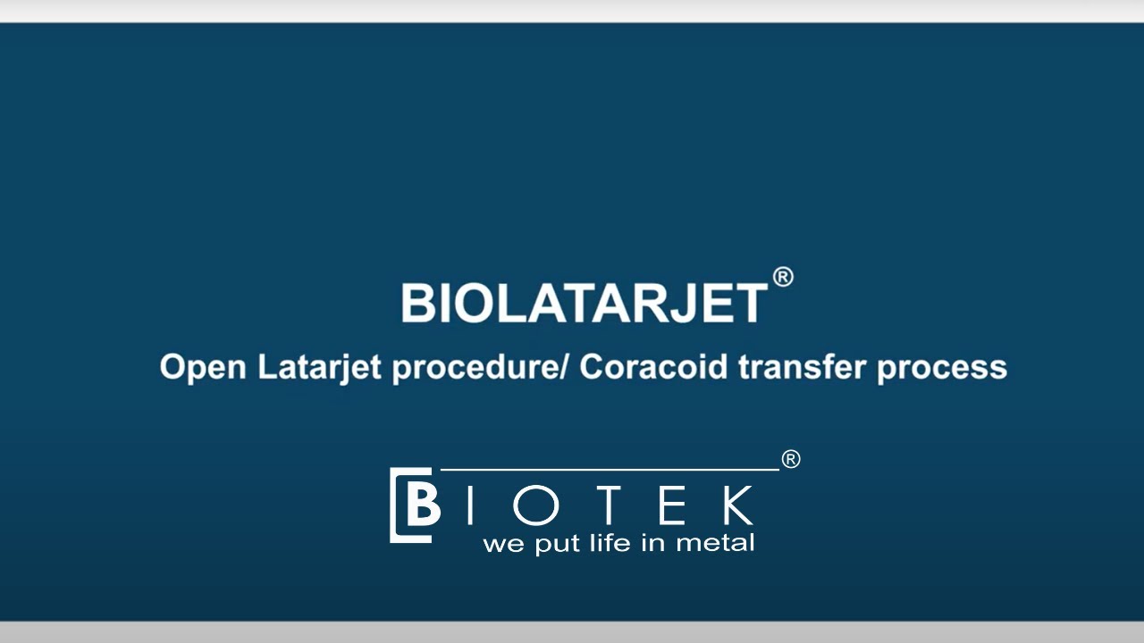 Open Latarjet Procedure/ Coracoid Transfer Process using BioLatarjet® | Animation