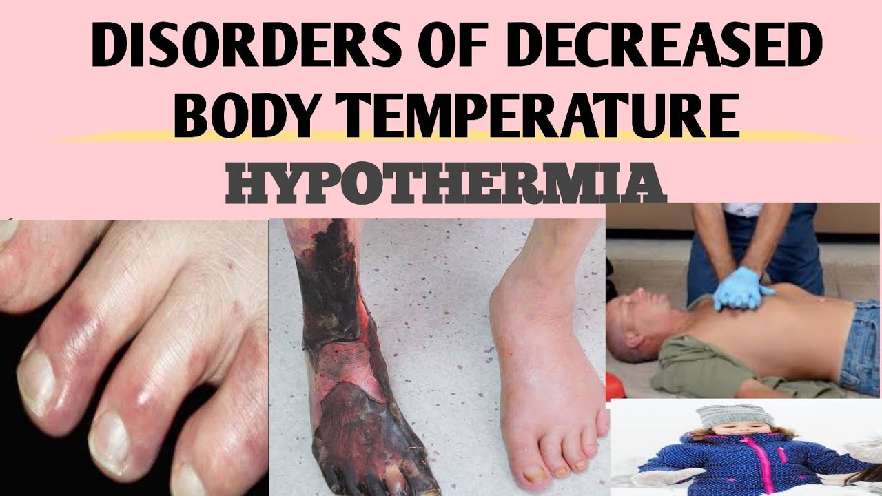 NSG FON 15 (B) HYPOTHERMIA/ INC syllabus