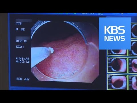 hpv high risk genotype levomekol din negi genitale în locuri intime