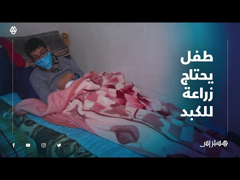 محمد.. طفل يحتاج عملية مكلفة لزراعة الكبد تنقذ حياته