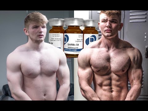 SARMS: I WENT BLIND | Teenagers experience w/ Sarms