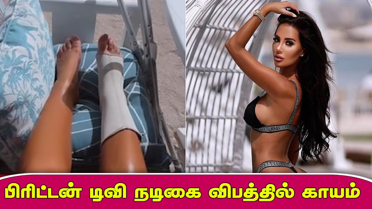 பரடடன-டவ-நடக-வபததல-கயம-british-tv-actress-injured-in-accident-britain-tamil-news