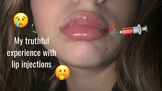 First Lip Injection Experience ! | Lilith Cavaliere