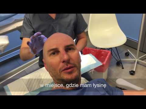 Od których włosy stają się łamliwe i wypadają Wypadanie włosów seria łopianu