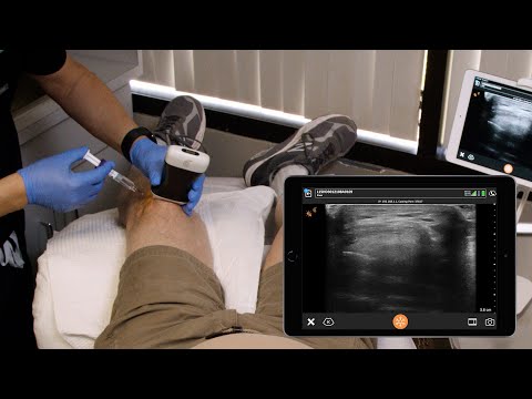 Hyorth Injection - Arthritis medicines supplier from india