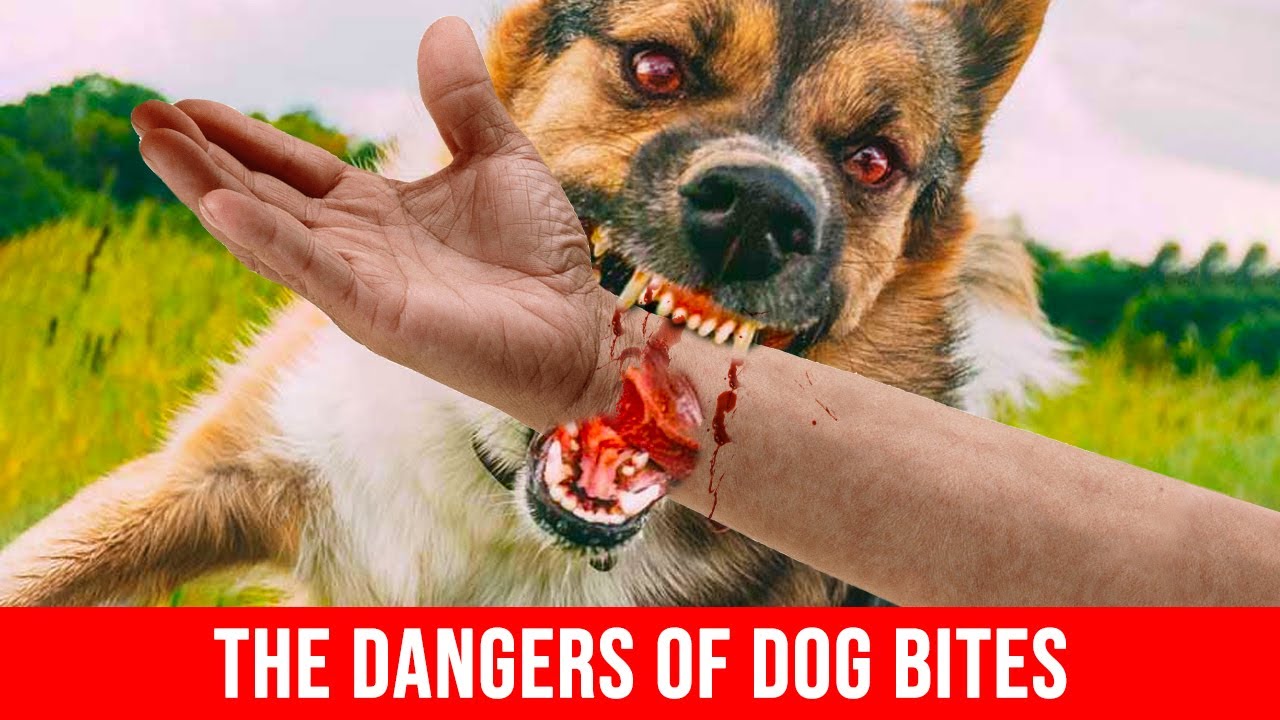 10 Amazing Facts About Dog Bites