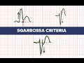 Sgarbossa Criteria MEDZCOOL