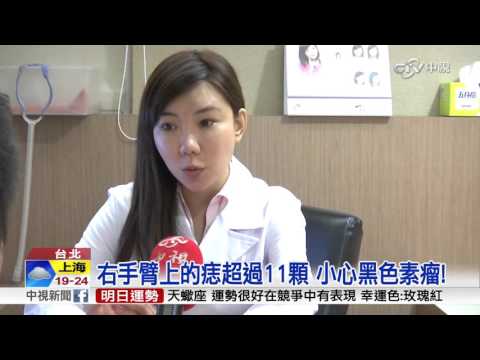 手臂長很多痣