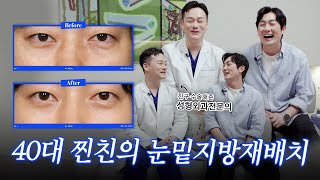 10년 젊어지는 #눈밑지방재배치 40대 찐친 수술 후기 l 윌비성형외과