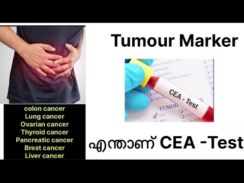 CEA -Test Tumour Marker എന്താണ്  CEA-ടെസ്റ്റ്?cancer കണ്ടെത്താനുള്ള എളുപ്പ വഴിയോ?🌸#ceatest#CEA