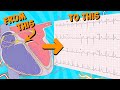 12 Lead ECG (Electrocardiogram) for beginners 🔥🤯.