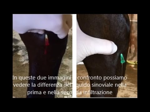 Come tirare la colonna vertebrale nella toracica cervicale Iniezioni nel ginocchio