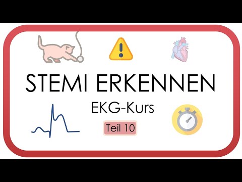 Recognizing STEMI in an ECG (ST-elevation myocardial infarction, ST segment, stages, case study) ...
