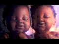 Cadbury Triplets