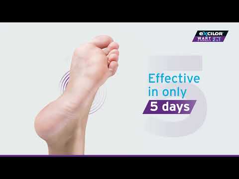 Excilor® 2 in 1 Warts Treatment TVC