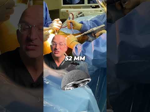 How Does a Hip Replacement Stay In Place? 🔨 Pressfit Hip Implants #shorts