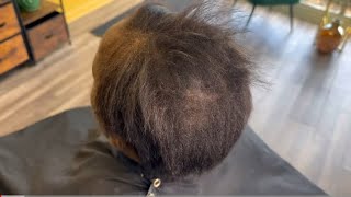 3 inch bald spot| Hair Regrowth after losing her hair