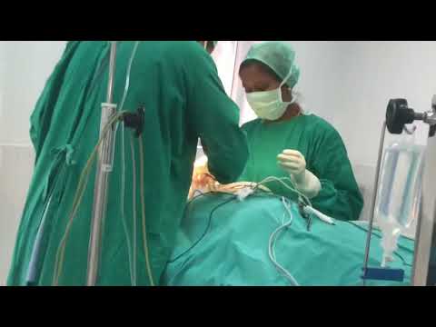 Orthognathic Surgery - Lefort 1 advancement and BSSO set back - Dr Sunil Richardson