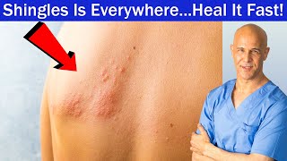Shingles Is Everywhere...Heal It Fast!  Dr. Mandell