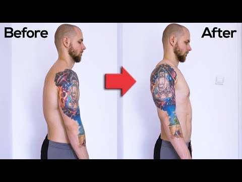 How I Fixed My Bad Posture (Rounded Shoulders)