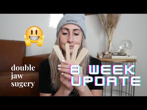 Double Jaw Surgery 8 Week Update