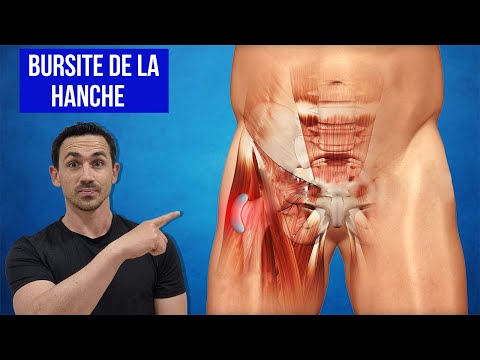 Bursite de la hanche : Exercices kiné