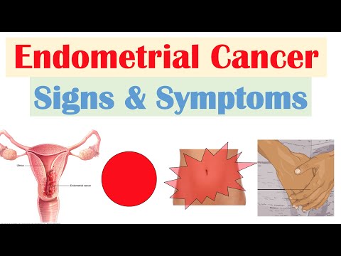 5 Steps to Fight Endometrial Cancer: Early Detection and Treatment is Key!