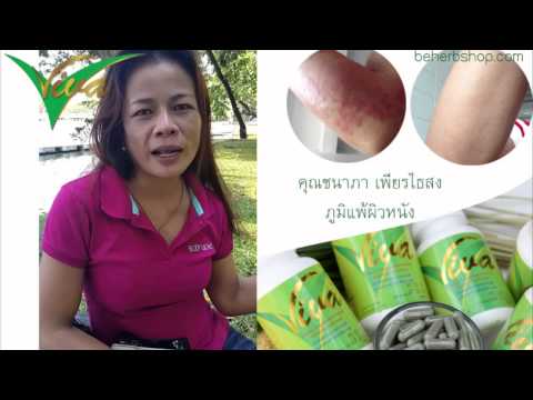 โรคสะเก็ดเงินราคาถูก รูปภาพกลากจริง