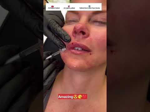 Trending on Youtube #Shorts