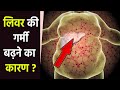 लिवर में गर्मी के लक्षण लिवर में गर्मी