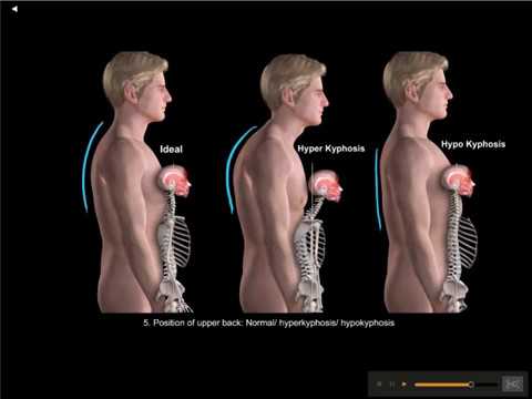 Posture by Muscle & Motion video