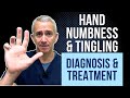 Hand Numbness & Tingling: Diagnosis & Treatment