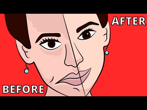 How to Reverse Bell's Palsy Facial Paralysis in Less than 4 minutes!