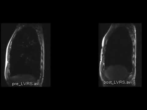 Dolore nella parte anteriore sdraiato sulla schiena Ad una deviazione del dolore della colonna vertebrale schiena