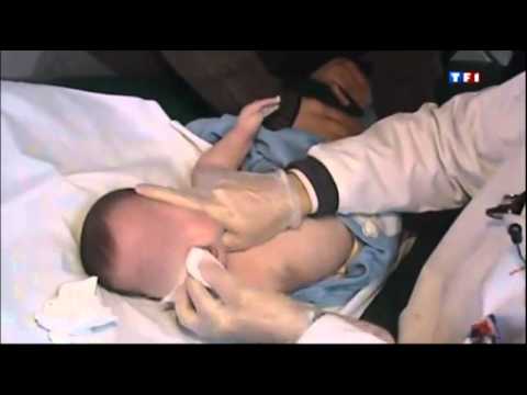 comment soigner bronchiolite