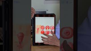 Download lagu Cervicitis mp3 Download lagu Cervicitis mp3