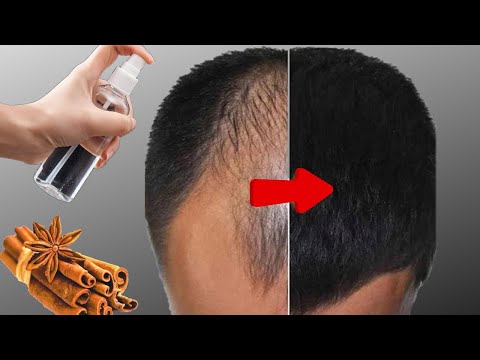 Hair grows fast and doesn't fall out, that's the best way! Hair grows like crazy! 💯