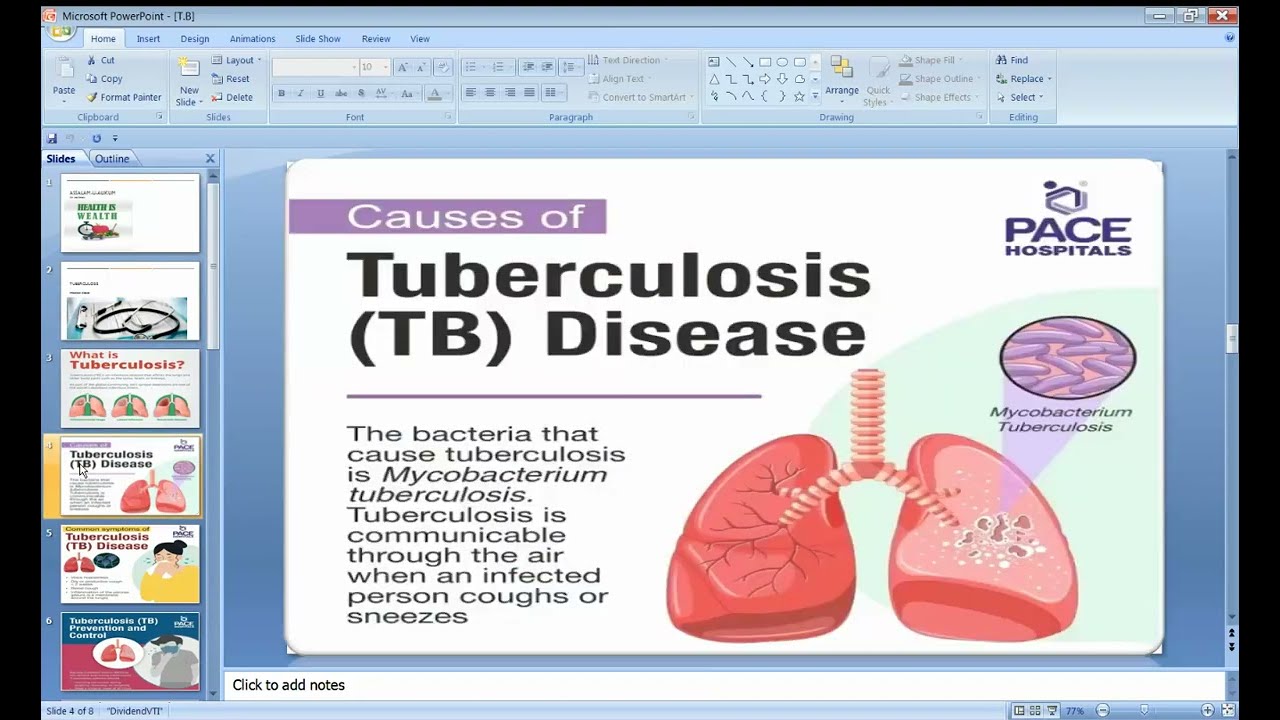 Power Point Presentation on Infectious Disease Tuberculosis | #2