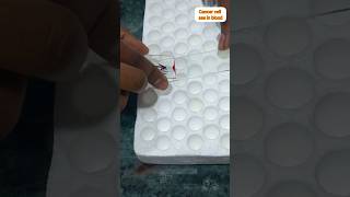 cancer cell under Microscope #cancer #short #shorts #microscope #viral #bloodcancer