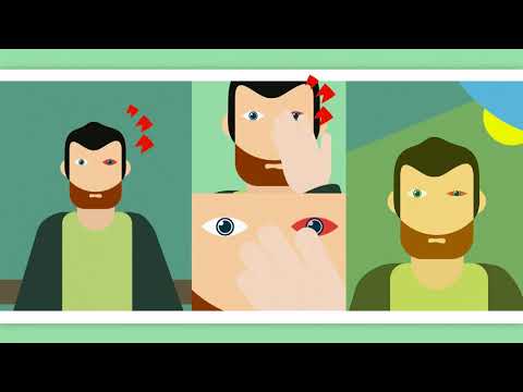 Axial Spondyloarthritis - Not just back pain