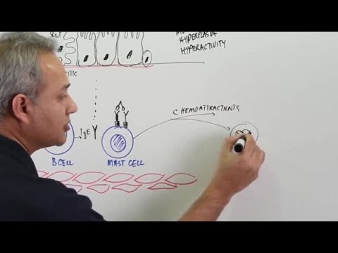 Asthma - Pathophysiology