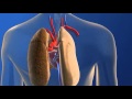 Lung Transplant