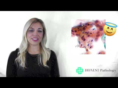 Pap Smear Results explained by a Pathologist: 4 Minute Path Report
