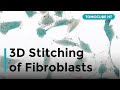 3D Stitching Of Fibroblasts
