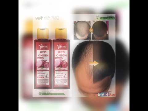 Onion Hair Oil And Shampoo
