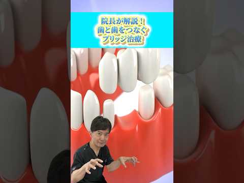 歯と歯をつなぐブリッジ治療とは⁉　#なかの歯科 #岡山歯医者 #ブリッジ #ブリッジ治療 #歯科治療