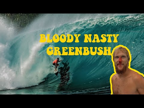 Heavy Dwellung mécht fir gnarly Surfen um Green Bush